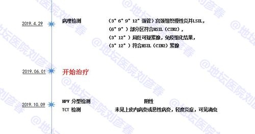 妇科活检结果lsil什么意思？ASC-US多久发展到LSIL