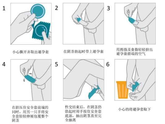 震环的正确使用方法？（怎么使用避孕套）